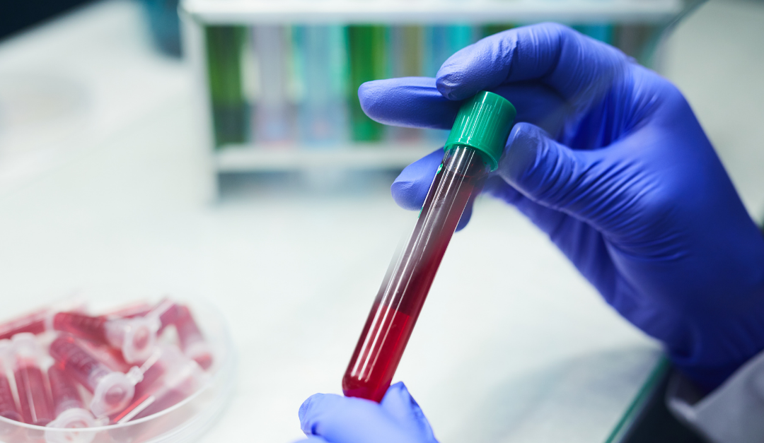 Parceria entre Binding Site e Enzipharma leva teste Freelite® ao Instituto Nacional de Câncer