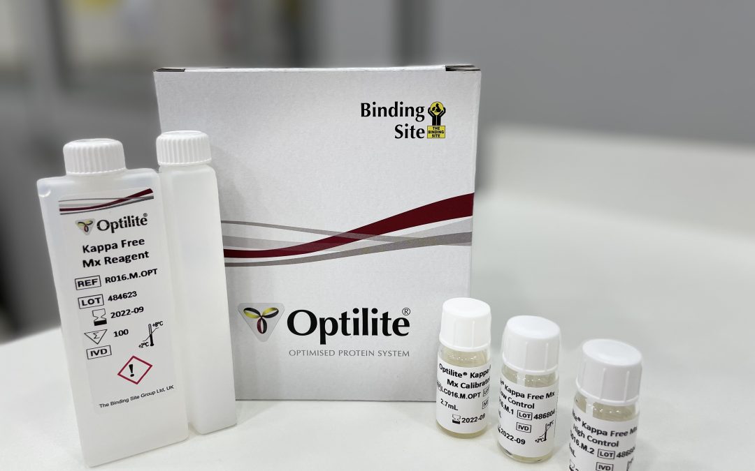 Brasil é pioneiro na utilização de teste inovador para diagnóstico da Esclerose Múltipla